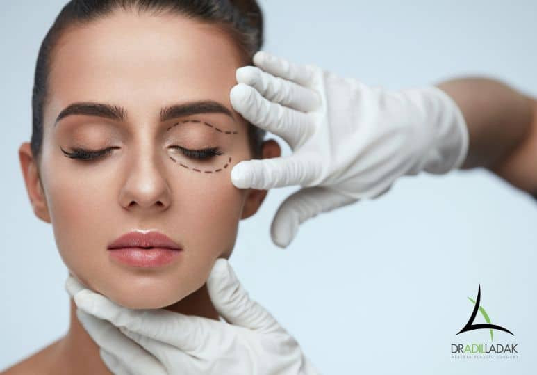 Plastic Surgery For Younger-Looking Eyes